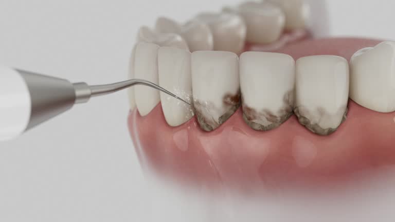 Reliable Teeth Cleaning And Checkup contractor in Black Hawk County County, IA by Dentist Open Now
